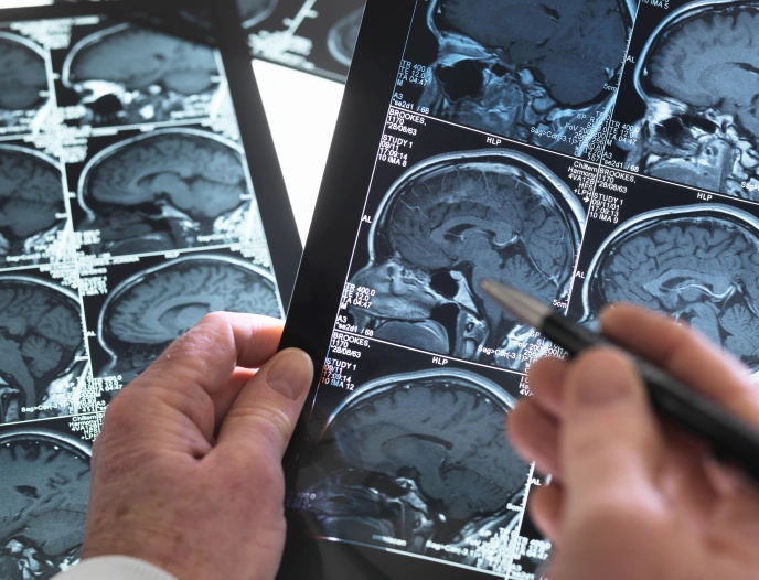 Traumatic Brain Injuries